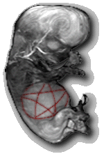 Distorted image of a foetus with a pentacle on its belly